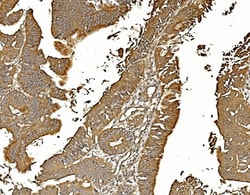 PP2A alpha Monoclonal Antibody (3B6), Invitrogen 100 &mu;g; Unconjugated:Antibodies,