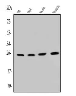 Invitrogen SNRPN Monoclonal Antibody (6F12) 100 &mu;g; Unconjugated:Antibodies,