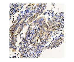 Invitrogen ADK Monoclonal Antibody (7F4) 100 &mu;g; Unconjugated:Antibodies,