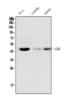 Invitrogen ADK Monoclonal Antibody (7F4) 100 &mu;g; Unconjugated:Antibodies,