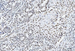 Invitrogen CtBP2 Monoclonal Antibody (10E9D2) 100 &mu;g; Unconjugated:Antibodies,