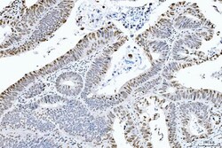 Invitrogen CtBP2 Monoclonal Antibody (10E9D2) 100 &mu;g; Unconjugated:Antibodies,