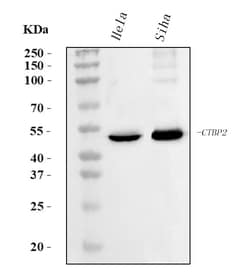 Invitrogen CtBP2 Monoclonal Antibody (10E9D2) 100 &mu;g; Unconjugated:Antibodies,