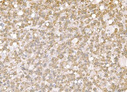 Invitrogen SND1 Monoclonal Antibody (6G3B4) 100 &mu;g; Unconjugated:Antibodies,