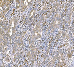Invitrogen SND1 Monoclonal Antibody (6G3B4) 100 &mu;g; Unconjugated:Antibodies,