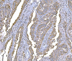 Invitrogen SND1 Monoclonal Antibody (6G3B4) 100 &mu;g; Unconjugated:Antibodies,