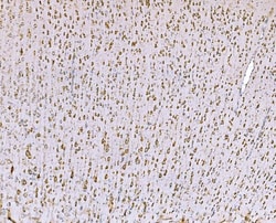 Invitrogen SND1 Monoclonal Antibody (6G3B4) 100 &mu;g; Unconjugated:Antibodies,