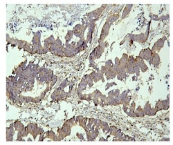 Invitrogen PPT1 Monoclonal Antibody (10F3) 100 &mu;g; Unconjugated:Antibodies,