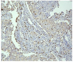 Invitrogen PPT1 Monoclonal Antibody (10F3) 100 &mu;g; Unconjugated:Antibodies,