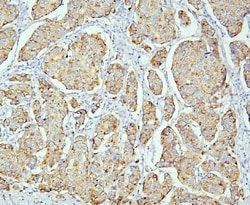 Invitrogen PPT1 Monoclonal Antibody (10F3) 100 &mu;g; Unconjugated:Antibodies,
