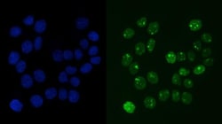 Invitrogen RCC1 Monoclonal Antibody (6B11E7) 100 &mu;g; Unconjugated:Antibodies,