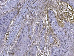 Invitrogen ILK Monoclonal Antibody (3C7E1) 100 &mu;g; Unconjugated:Antibodies,