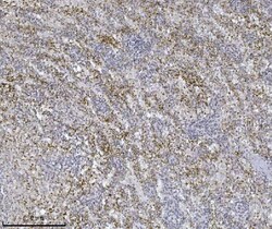 Invitrogen ILK Monoclonal Antibody (3C7E1) 100 &mu;g; Unconjugated:Antibodies,