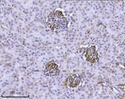 Invitrogen ILK Monoclonal Antibody (3C7E1) 100 &mu;g; Unconjugated:Antibodies,