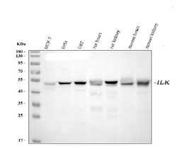 Invitrogen ILK Monoclonal Antibody (3C7E1) 100 &mu;g; Unconjugated:Antibodies,