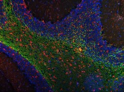 Invitrogen MAG Monoclonal Antibody (2G11) 100 &mu;g; Unconjugated:Antibodies,