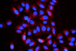 Invitrogen Cyclophilin B Monoclonal Antibody (11C11) 100 &mu;g; Unconjugated:Antibodies,