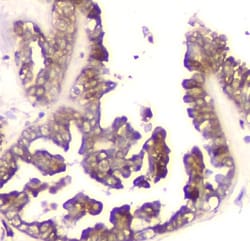 Invitrogen Cyclophilin B Monoclonal Antibody (11C11) 100 &mu;g; Unconjugated:Antibodies,