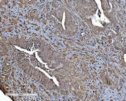 Invitrogen REA Monoclonal Antibody (2B5) 100 &mu;g | Buy Online | Invitrogen&trade; | Fisher Scientific
