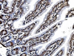 Invitrogen REA Monoclonal Antibody (2B5) 100 &mu;g | Buy Online | Invitrogen&trade; | Fisher Scientific