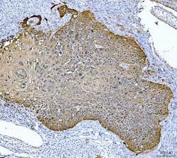 Invitrogen Maspin Monoclonal Antibody (7G4E1) 100 &mu;g; Unconjugated:Antibodies,