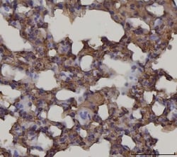 Invitrogen RAGE Monoclonal Antibody (5C6C1) 100 &mu;g; Unconjugated:Antibodies,