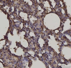 Invitrogen RAGE Monoclonal Antibody (5C6C1) 100 &mu;g; Unconjugated:Antibodies,