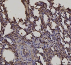 Invitrogen RAGE Monoclonal Antibody (5C6C1) 100 &mu;g; Unconjugated:Antibodies,