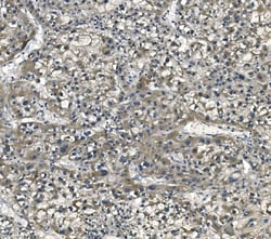 Invitrogen eRF1 Monoclonal Antibody (3E5) 100 &mu;g; Unconjugated:Antibodies,