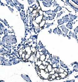 Invitrogen eRF1 Monoclonal Antibody (3E5) 100 &mu;g; Unconjugated:Antibodies,