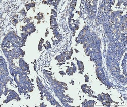 Invitrogen ACSL4 Monoclonal Antibody (4I7) 100 &mu;g; Unconjugated:Antibodies,