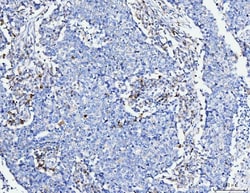 Invitrogen ACSL4 Monoclonal Antibody (4I7) 100 &mu;g; Unconjugated:Antibodies,