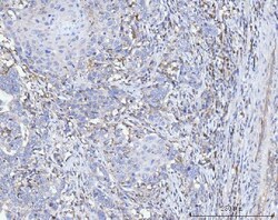 Invitrogen ACSL4 Monoclonal Antibody (4I7) 100 &mu;g; Unconjugated:Antibodies,