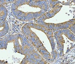 Invitrogen ACSL4 Monoclonal Antibody (4I7) 100 &mu;g; Unconjugated:Antibodies,