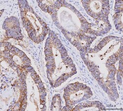 Invitrogen Claudin 3 Monoclonal Antibody (4C7D2) 100 &mu;g; Unconjugated:Antibodies,