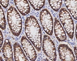Invitrogen Claudin 3 Monoclonal Antibody (4C7D2) 100 &mu;g; Unconjugated:Antibodies,