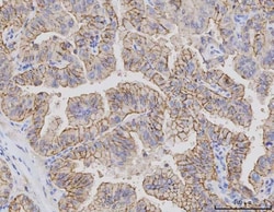 Invitrogen Claudin 3 Monoclonal Antibody (4C7D2) 100 &mu;g; Unconjugated:Antibodies,