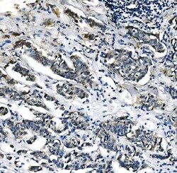 Invitrogen PCK2 Monoclonal Antibody (3F7) 100 &mu;g; Unconjugated:Antibodies,