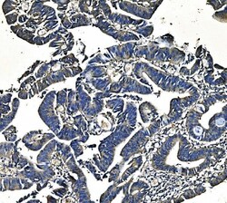 Invitrogen PCK2 Monoclonal Antibody (3F7) 100 &mu;g; Unconjugated:Antibodies,