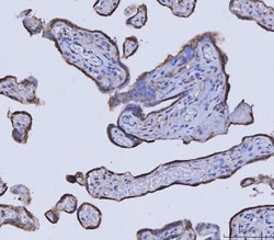 Invitrogen GLDC Monoclonal Antibody (3D3D3) 100 &mu;g; Unconjugated:Antibodies,