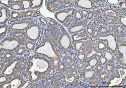 Invitrogen GLDC Monoclonal Antibody (3D3D3) 100 &mu;g; Unconjugated:Antibodies,
