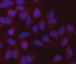 Invitrogen MDH2 Monoclonal Antibody (5D8C1) 100 &mu;g | Buy Online | Invitrogen&trade; | Fisher Scientific
