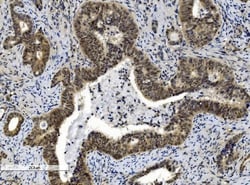 Invitrogen CBX8 Monoclonal Antibody (8G7) 100 &mu;g; Unconjugated:Antibodies,