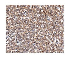 Invitrogen CKAP5 Monoclonal Antibody (3C13) 100 &mu;g; Unconjugated:Antibodies,