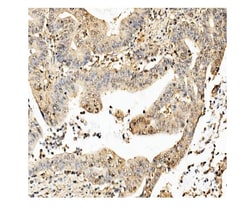 Invitrogen CKAP5 Monoclonal Antibody (3C13) 100 &mu;g; Unconjugated:Antibodies,