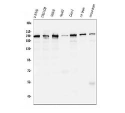 Invitrogen CKAP5 Monoclonal Antibody (3C13) 100 &mu;g; Unconjugated:Antibodies,