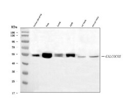 Invitrogen CALCOCO2 Monoclonal Antibody (9E2F2) 100 &mu;g; Unconjugated:Antibodies,