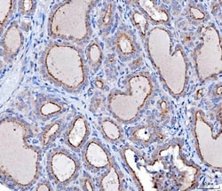 Invitrogen KLHL12 Monoclonal Antibody (2G11D1) 100 &mu;g; Unconjugated:Antibodies,