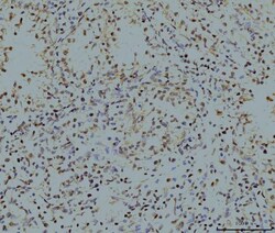 Invitrogen LSM8 Monoclonal Antibody (6B11) 100 &mu;g; Unconjugated:Antibodies,