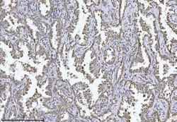 Invitrogen PMPCB Monoclonal Antibody (9F13E4) 100 &mu;g; Unconjugated:Antibodies,